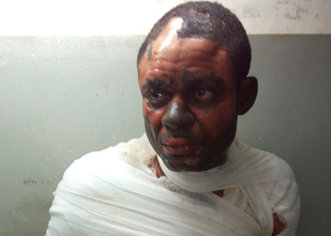 Lawrence Nkem - in critical condition